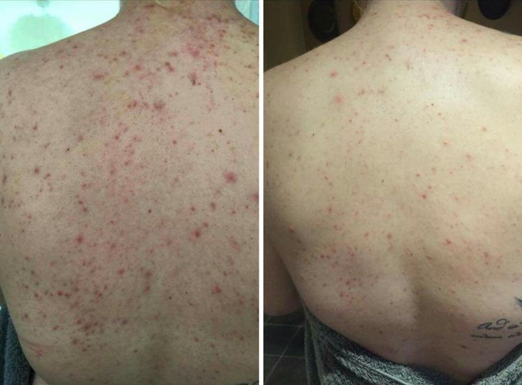 Олена Скоропад